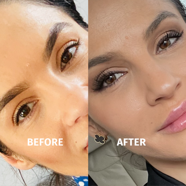 before after linfinity lash serum