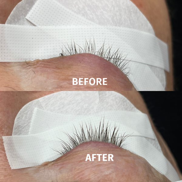 before after linfinity lash serum